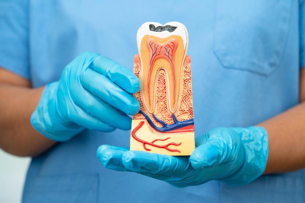 gum-disease-1 gum disease