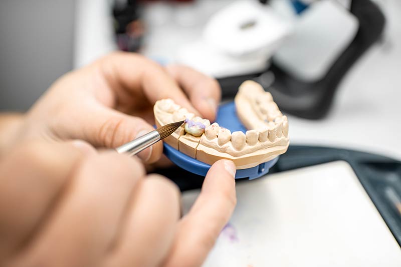 types-of-dental-crowns-2