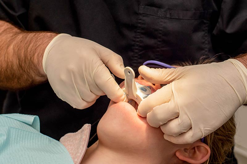 types-of-dental-crowns-3